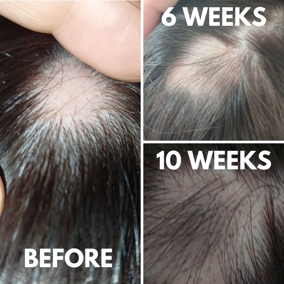 Hair Growth & Hydration Oil - Original Formula