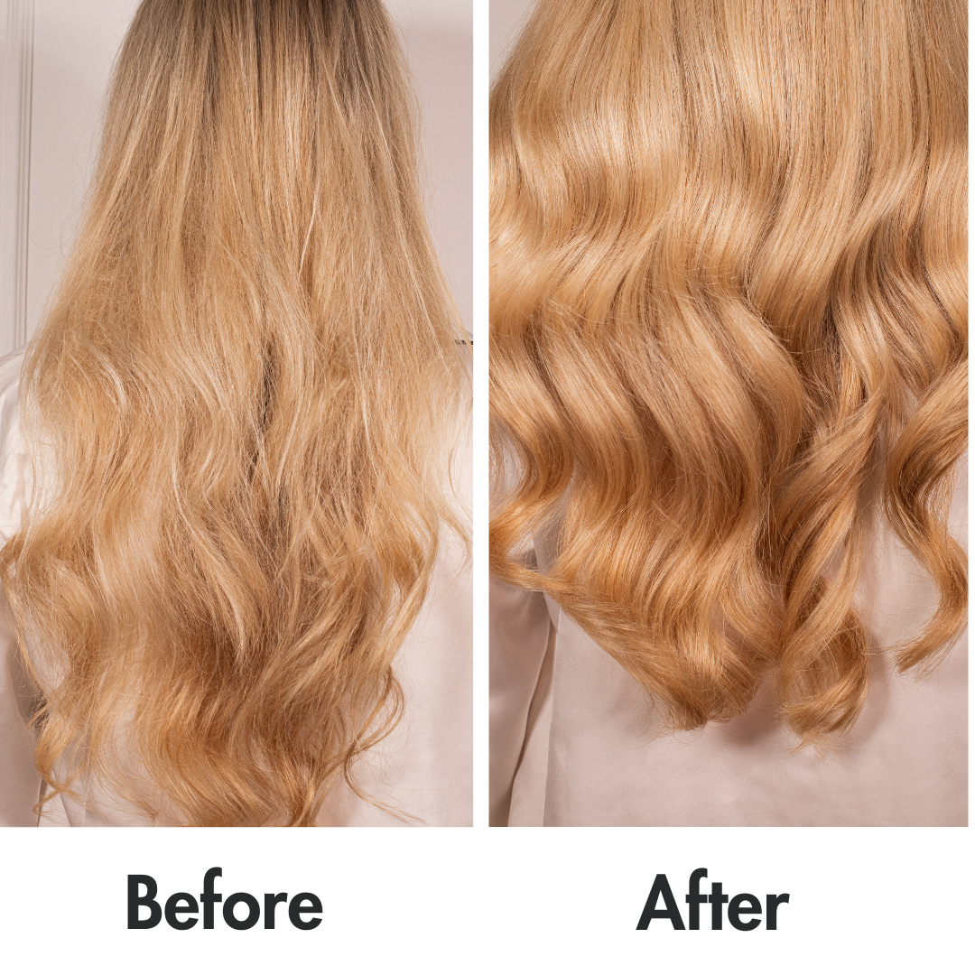 before and after hair growth treatment