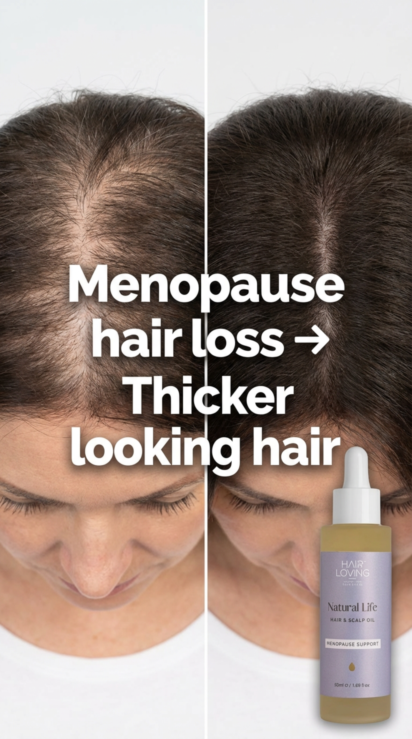 Natural Life Hair &amp; Scalp Oil for Menopause Support | For Hair Growth with Rosemary, Geranium Rose &amp; Lavender Blend