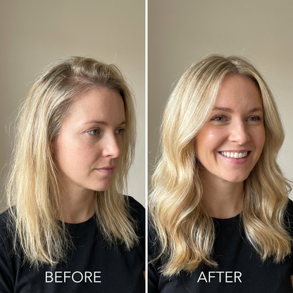 Silk Renewal Conditioner – Women’s Conditioner for Dry, Thinning Hair &amp; Hair Fall Control